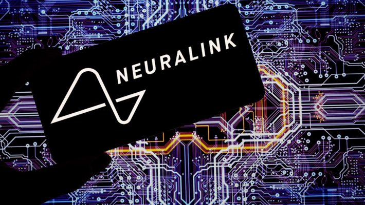 Brain-computer interface device showing neural signals and AI integration